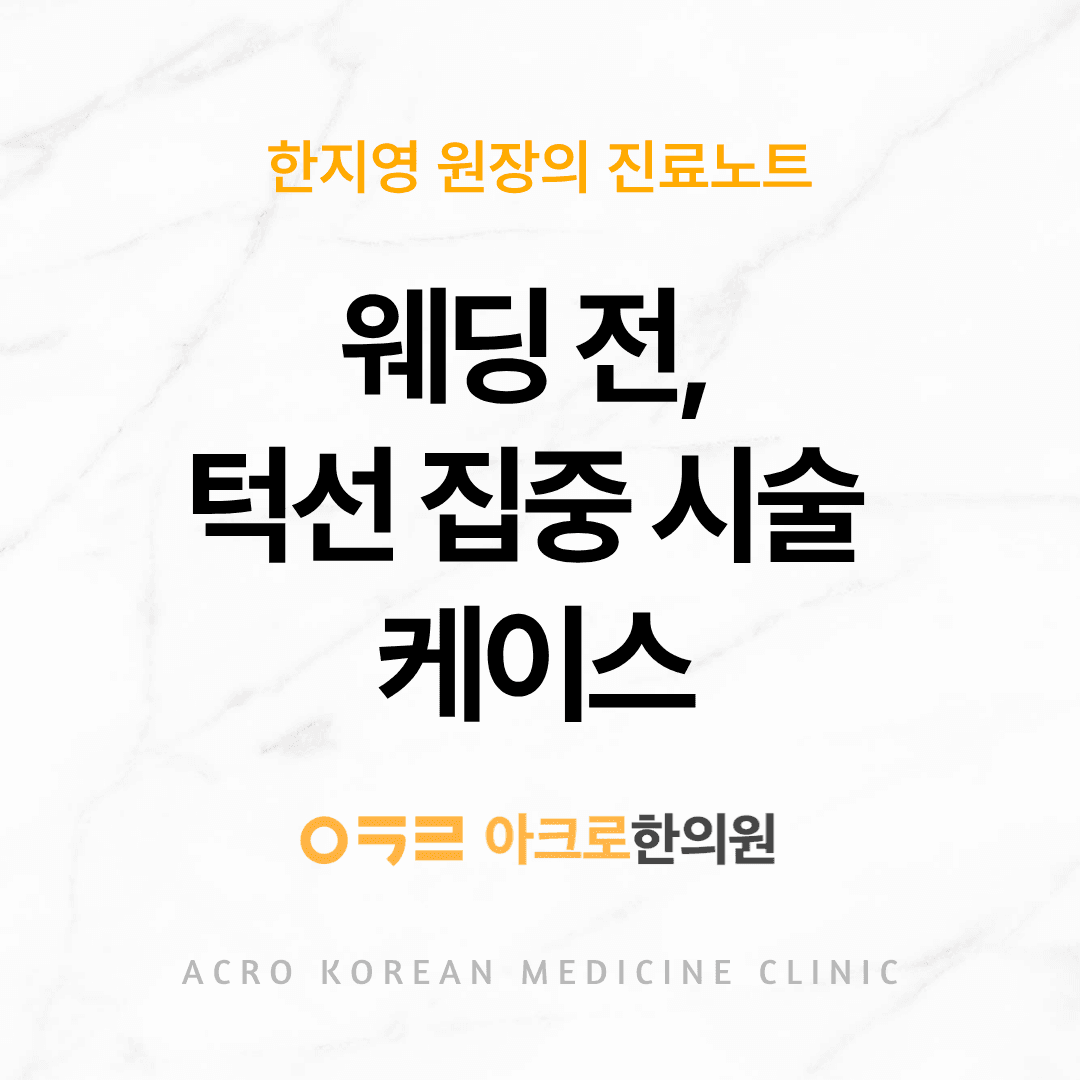 웨딩 전, 턱선 집중 시술 케이스 – 극초단파 지방분해약침