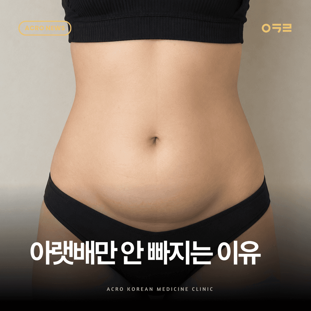 아랫배만 안 빠진다면? 하복부비만 유형별 원인 정리