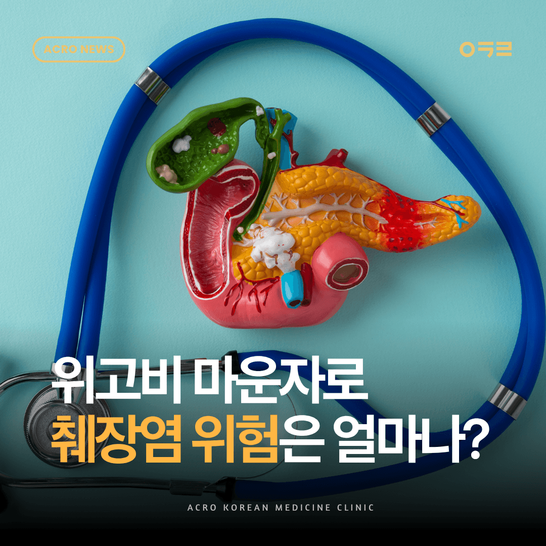 위고비 마운자로 췌장염 위험은 실제로 얼마나 될까? 마운자로 임상시험까지 분석했습니다