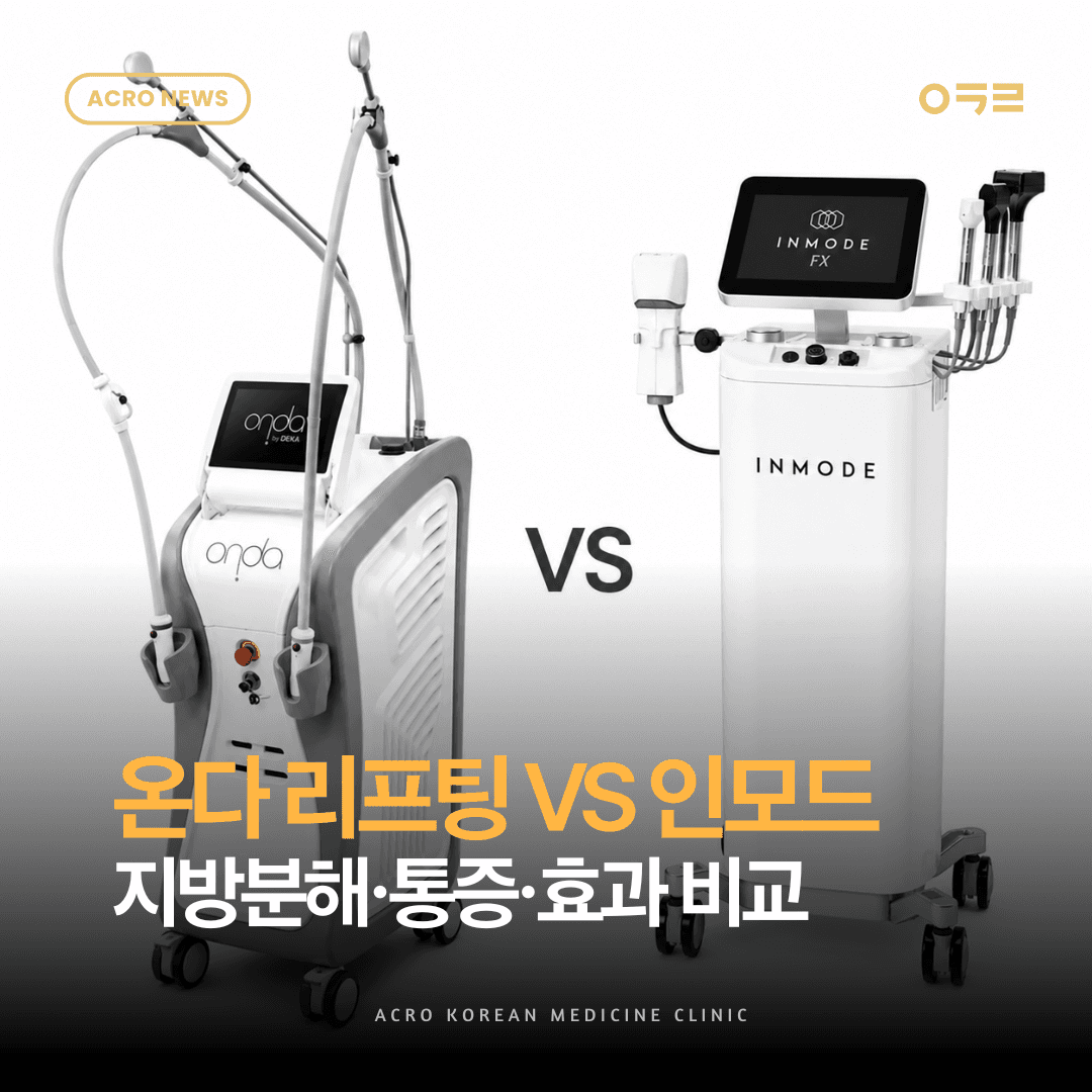 온다리프팅과 인모드FX 차이 총정리|지방분해·통증·효과 비교