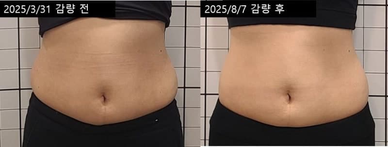 출산 후 감량 7.2kg (25.03.31 ~ 25.08.07)