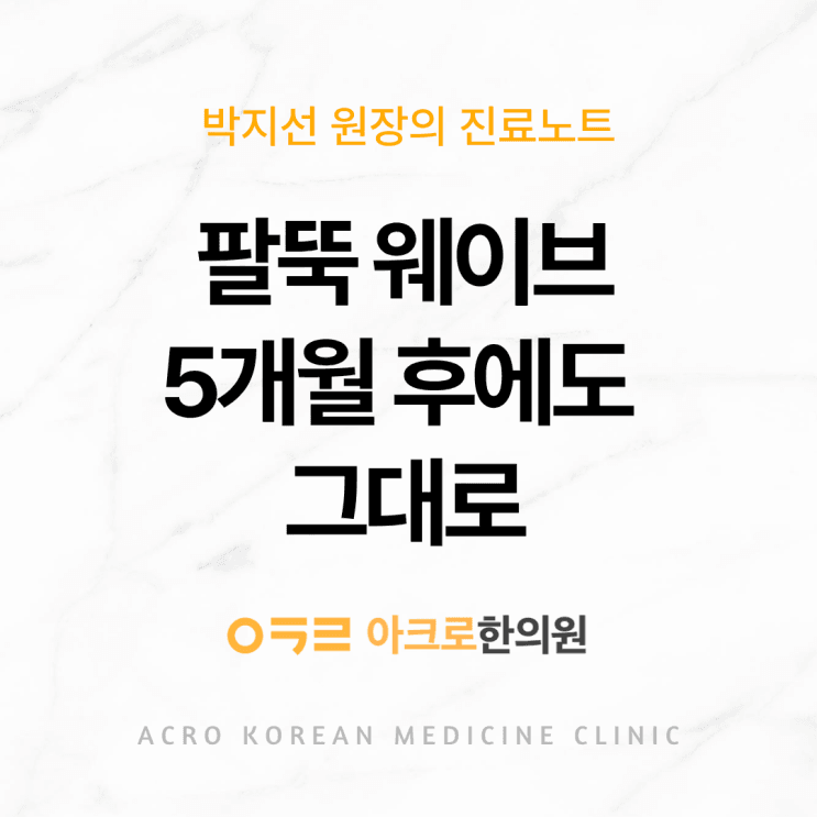 手臂ACRO Wave，5個月後線條依然保持的原因