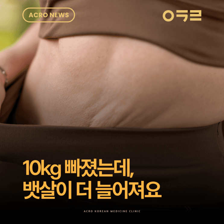 減重10kg後的腹部鬆弛應對法，Ozempic身體管理指南